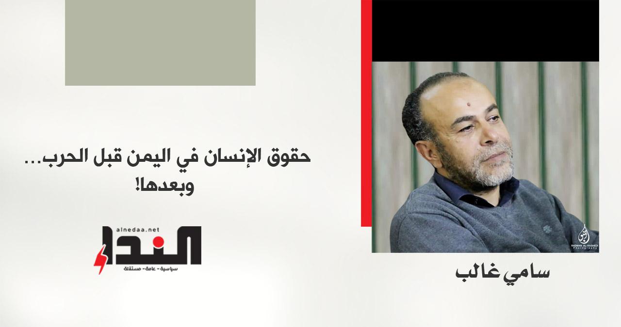 حقوق الإنسان في اليمن قبل الحرب … وبعدها! (1)